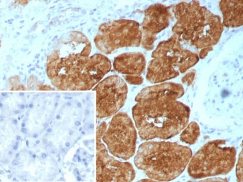 IHC staining of FFPE human kidney tissue with recombinant Fatty Acid Binding Protein 1 antibody (clo