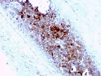 CD63 Antibody / LAMP-3