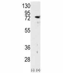 Western blot analysis of PKC delta antibody and 293 cell lysate either nontransfected (Lane 1) or tr