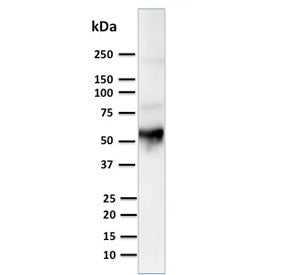 KRT10 Antibody / Cytokeratin 10