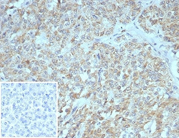 IHC staining of FFPE human pancreas tissue with SSTR2 antibody (clone SSTR2/7532). Inset: PBS used i