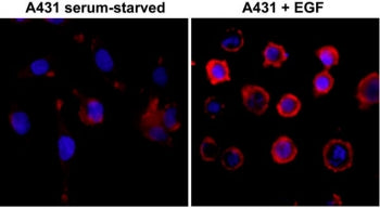 ICC test of serum-starved human A431 cells non-treated or treated with EGF, using the recombinant Ph