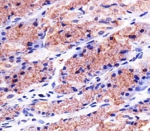 Prohibitin Antibody (PHB1)
