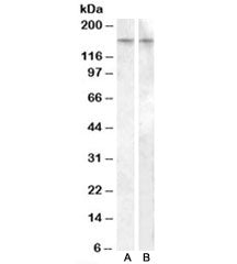 Western blot testing of human amygdala lysate with AVPR1B antibody, <a href=../tds/avpr1b-antibody-r