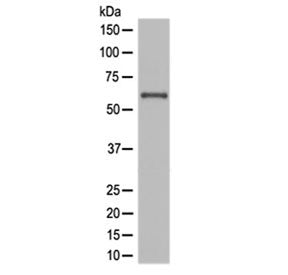 Western blot testing of human JAR cell lysate with NOX4 antibody at 0.5ug/ml. Expected molecular wei