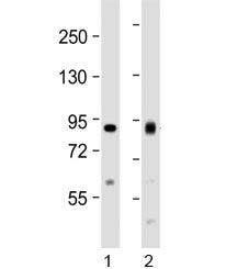 Western blot testing of human 1) HeLa and 2) Jurkat cell lysate with ACO2 antibody at 1:1000. Predic
