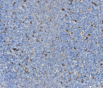 IHC staining of FFPE human tonsil with Niemann Pick C2 antibody. HIER: boil tissue sections in pH8 E