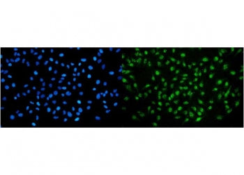 Immunofluorescent staining of FFPE human HeLa cells with NIRF antibody (green) and DAPI nuclear stai