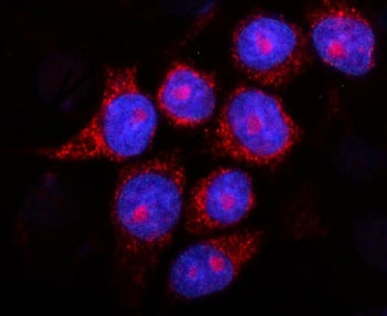 Immunofluorescent staining of FFPE human MCF7 cells with PSEN2 antibody (green) and DAPI nuclear sta
