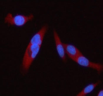 Immunofluorescent staining of FFPE human PC-3 cells with STAT2 antibody (red) and DAPI nuclear stain