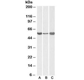 Western blot testing of human [A] and mouse [B] liver, and rat [C] testis lysate with ALDH1A1 antibo