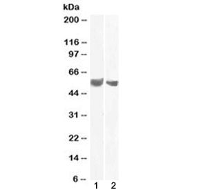 Western blot testing of human 1) placenta and 2) testis lysate with B7-H3 antibody at 0.1 and 2 ug/m