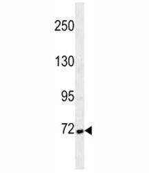 Cortactin antibody western blot analysis in MDA-MB231 lysate. Molecular weight: routinely observed a