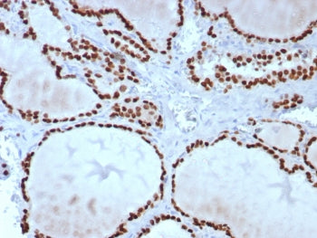 IHC staining of FFPE human thyroid tissue with TTF-1 antibody (clone TTF1/8427). HIER: boil tissue s