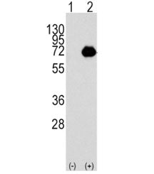Western blot analysis of ACOX1 antibody and 293 cell lysate either nontransfected (Lane 1) or transi