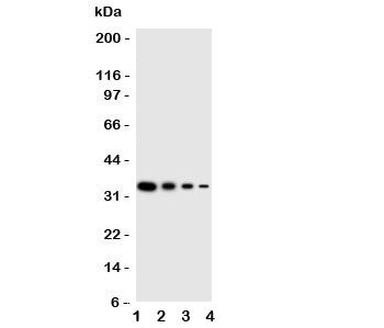 PKR Antibody (PRKR)