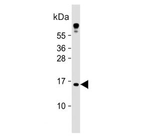 Western blot testing of human HeLa cell lysate with Tumor suppressor ARF antibody. Predicted molecul