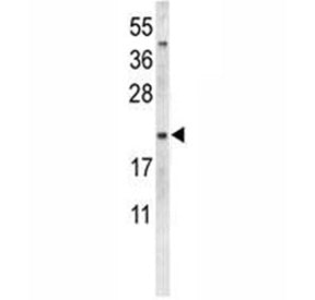 Western blot analysis of Neurophysin 1 antibody and MDA-MB231 lysate. Predicted molecular weight ~12