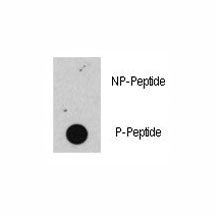 Dot blot analysis of phospho-Rb antibody. 50ng of phos-peptide or nonphos-peptide per dot were spott