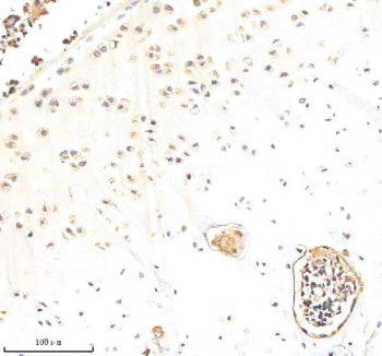 Immunohistochemical staining of Biglycan/BGN using anti-BGN antibody. Biglycan/BGN was detected in a