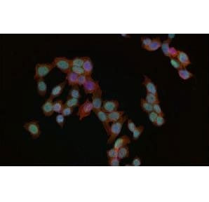 Immunofluorescent staining of FFPE human HeLa cells with Phospho-MDM2 antibody (green), phalloidin (