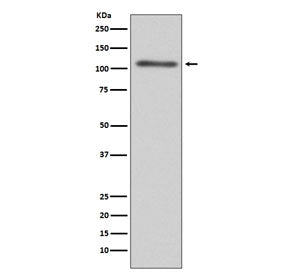 C3 Antibody / Complement C3