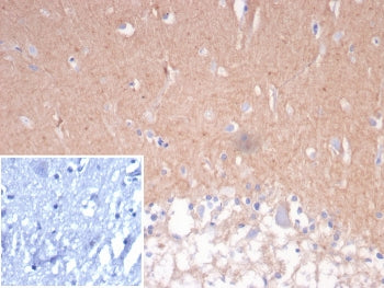 IHC staining of FFPE human cerebellum tissue with CD56 antibody (clone NCAM/7524). Inset: PBS used i