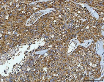 CAD Protein Antibody