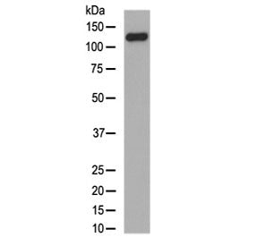 Western blot testing of human skin lysate with Collagen XVII antibody at 0.5ug/ml. Expected molecula
