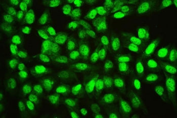 Immunofluorescent staining of FFPE human U-2 OS cells with Ran antibody. HIER: boil tissue sections 