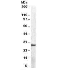 Western blot testing of mouse spleen lysate with APOBEC1 antibody at 1ug/ml. Predicted molecular wei