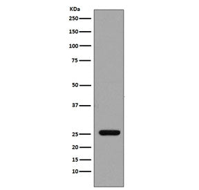 Western blot testing of human recombinant protein with GST pi antibody. Predicted molecular weight ~