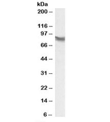 Western blot testing of HepG2 lysate with LPP antibody at 0.1ug/ml. Predicted molecular weight: ~66k