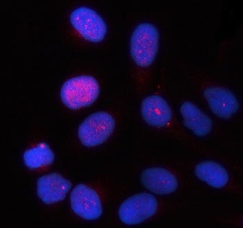 Immunofluorescent staining of FFPE human HeLa cells with TTC9 antibody (red) and DAPI nuclear stain 