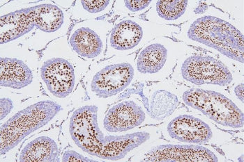 IHC staining of FFPE rat testis with DR1 antibody. HIER: boil tissue sections in pH8 EDTA for 20 min