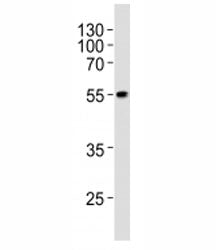 Western blot analysis of lysate from WiDr cell line using PDX1 at 1:1000. Predicted molecular weight
