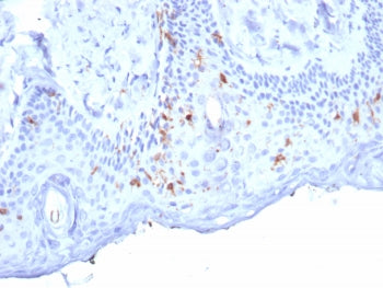 IHC staining of FFPE human skin tissue with Langerin antibody (clone LGRN/7357). HIER: boil tissue s