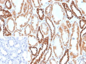 IHC staining of FFPE human kidney tissue with Phospholipase A2 receptor 1 antibody (clone PLA2R1/489