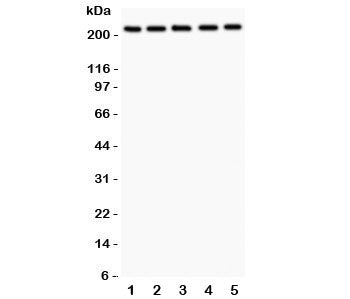 Western blot testing of TSC2 antibody and human samples 1: U20S; 2: PANC; 3: HEPG2; 4: A549; 5: COLO
