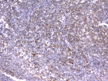 IHC testing of FFPE human tonsil tissue with ITGB2 antibody at 2ug/ml. HIER: boil tissue sections in