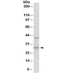 Western blot testing of mouse brain lysate with Fgf23 antibody at 0.5ug/ml. Predicted molecular weig