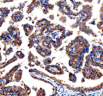 Immunohistochemical staining of GEF-H1/ARHGEF2 using anti-ARHGEF2 antibody. GEF-H1/ARHGEF2 was detec