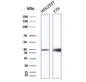 Western blot testing of human HEK293 and Y79 cell lysate with recombinant CKB antibody. Predicted mo