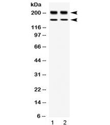 WRN Antibody / Werner syndrome ATP-dependent helicase