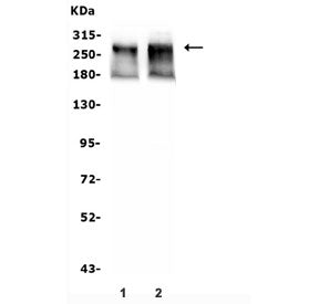 Western blot testing of human 1) A549 and 2) HeLa lysate with ATRX antibody. Expected molecular weig