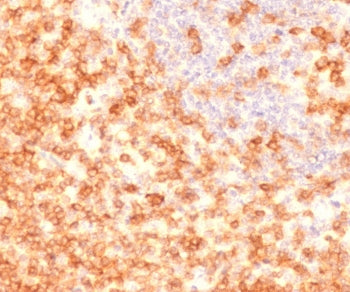 IHC testing of FFPE human tonsil tissue with recombinant CD27 antibody (clone CDLA27-1R). Required H