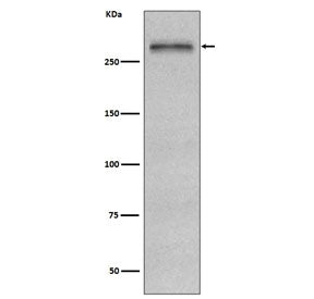 Western blot testing of human HepG2 cell lysate with Fibronectin antibody. Predicted molecular weigh