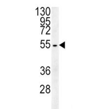 Tubulin beta 3 Antibody (TUBB3)