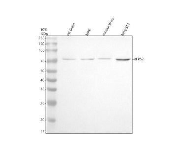 Western blot analysis of REPS2 using anti-REPS2 antibody. Electrophoresis was performed on a 10% SDS
