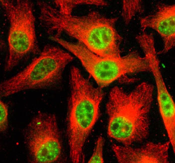Immunofluorescent staining of PRP4K using anti-PRP4K antibody (green) and anti-Beta Tubulin antibody